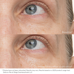 OBAGI Daily Hydro-Drops Rejuvenating Eye Gel Cream